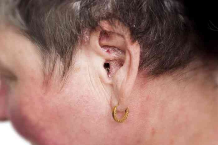 A woman with dirty ear