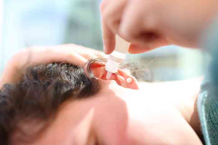 a doctor putting hydrogen peroxide in a patient's ear